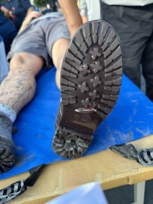 img 1