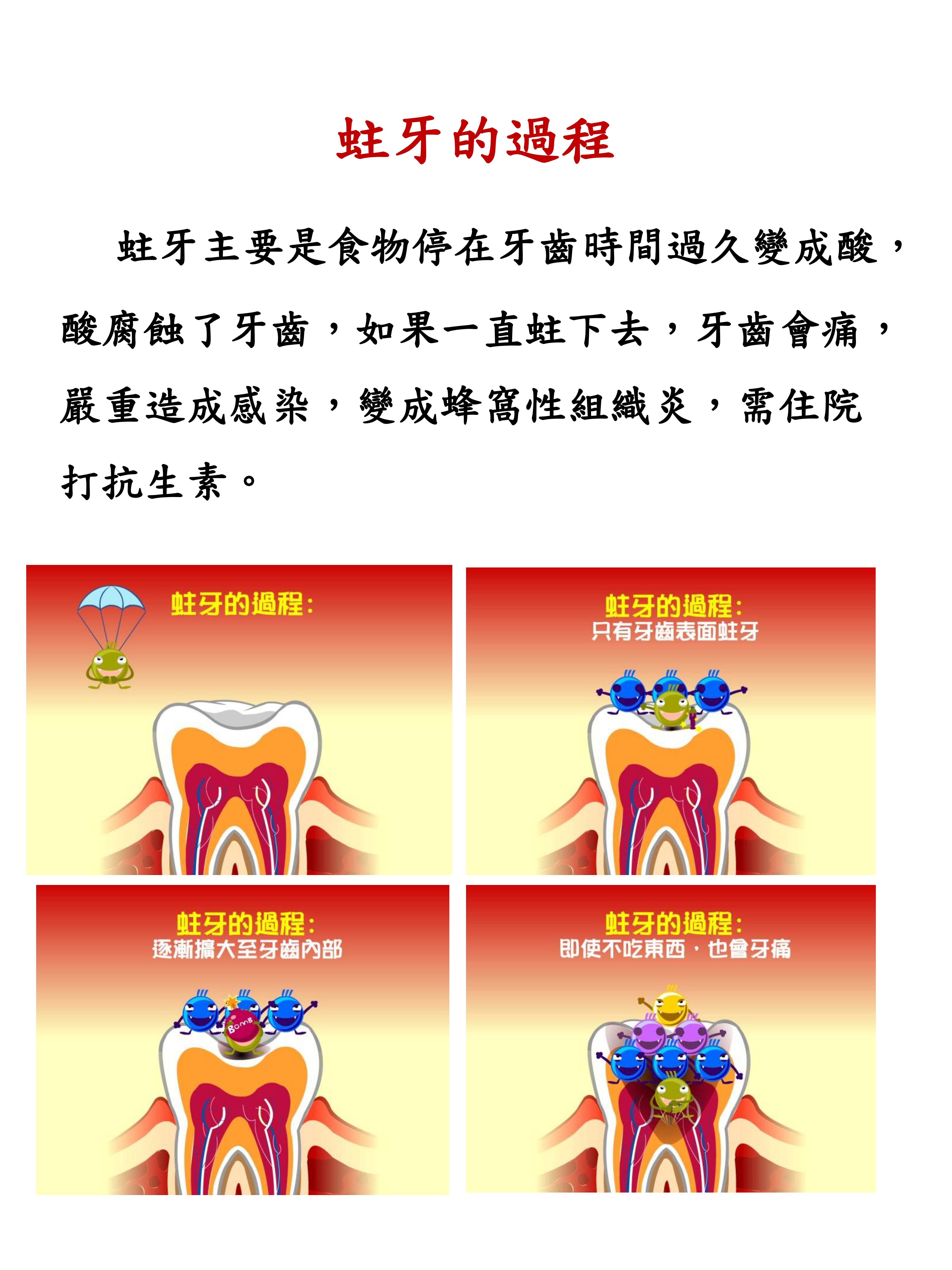 07 預防小兒蛀牙怎麼做3