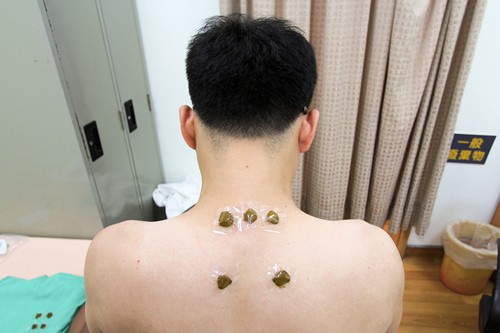 冬病夏治好療效　三伏貼即日起接受預約