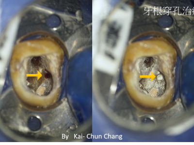 顯微鏡在牙科的應用領域