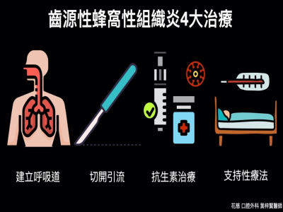 淺談齒源性蜂窩性組織炎 part 2 治療