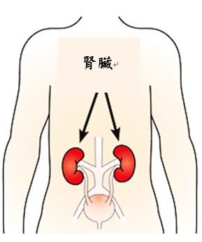第一次洗腎