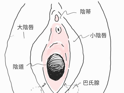 會陰整型手術的兩種原因
